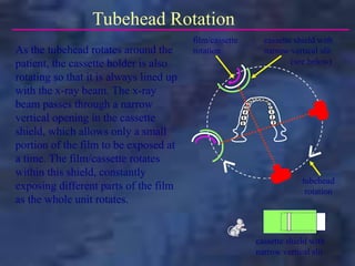 cassette shield with
narrow vertical slit
tubehead
rotation
film/cassette
rotation
Tubehead Rotation
As the tubehead rotates around the
patient, the cassette holder is also
rotating so that it is always lined up
with the x-ray beam. The x-ray
beam passes through a narrow
vertical opening in the cassette
shield, which allows only a small
portion of the film to be exposed at
a time. The film/cassette rotates
within this shield, constantly
exposing different parts of the film
as the whole unit rotates.
cassette shield with
narrow vertical slit
(see below)
 