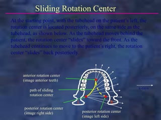 posterior rotation center
(image right side)
anterior rotation center
(image anterior teeth)
path of sliding
rotation center
posterior rotation center
(image left side)
Sliding Rotation Center
L R
At the starting point, with the tubehead on the patient’s left, the
rotation center is located posteriorly, on the same side as the
tubehead, as shown below. As the tubehead moves behind the
patient, the rotation center “slides” toward the front. As the
tubehead continues to move to the patient’s right, the rotation
center “slides” back posteriorly.
x-rays
 