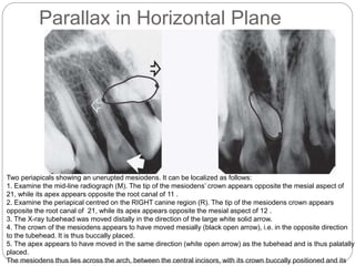 Dpt Radiography Panoramic radiography (dental panoramic tomography dpt) and periapical ...