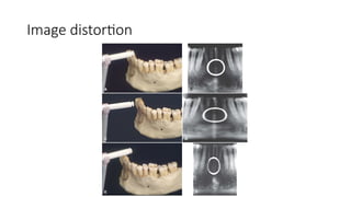 Panoramic x-ray operations-extra oral radiography.pptx