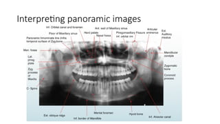 Panoramic Radiograph Label Panoramic x-ray operations-extra oral radiography.pptx