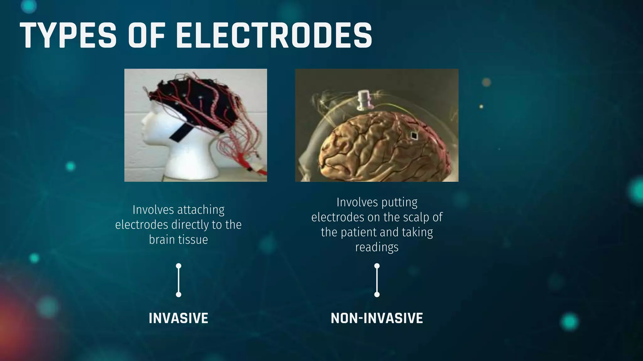 Involves attaching
electrodes directly to the
brain tissue
Involves putting
electrodes on the scalp of
the patient and taking
readings
INVASIVE NON-INVASIVE
TYPES OF ELECTRODES
 