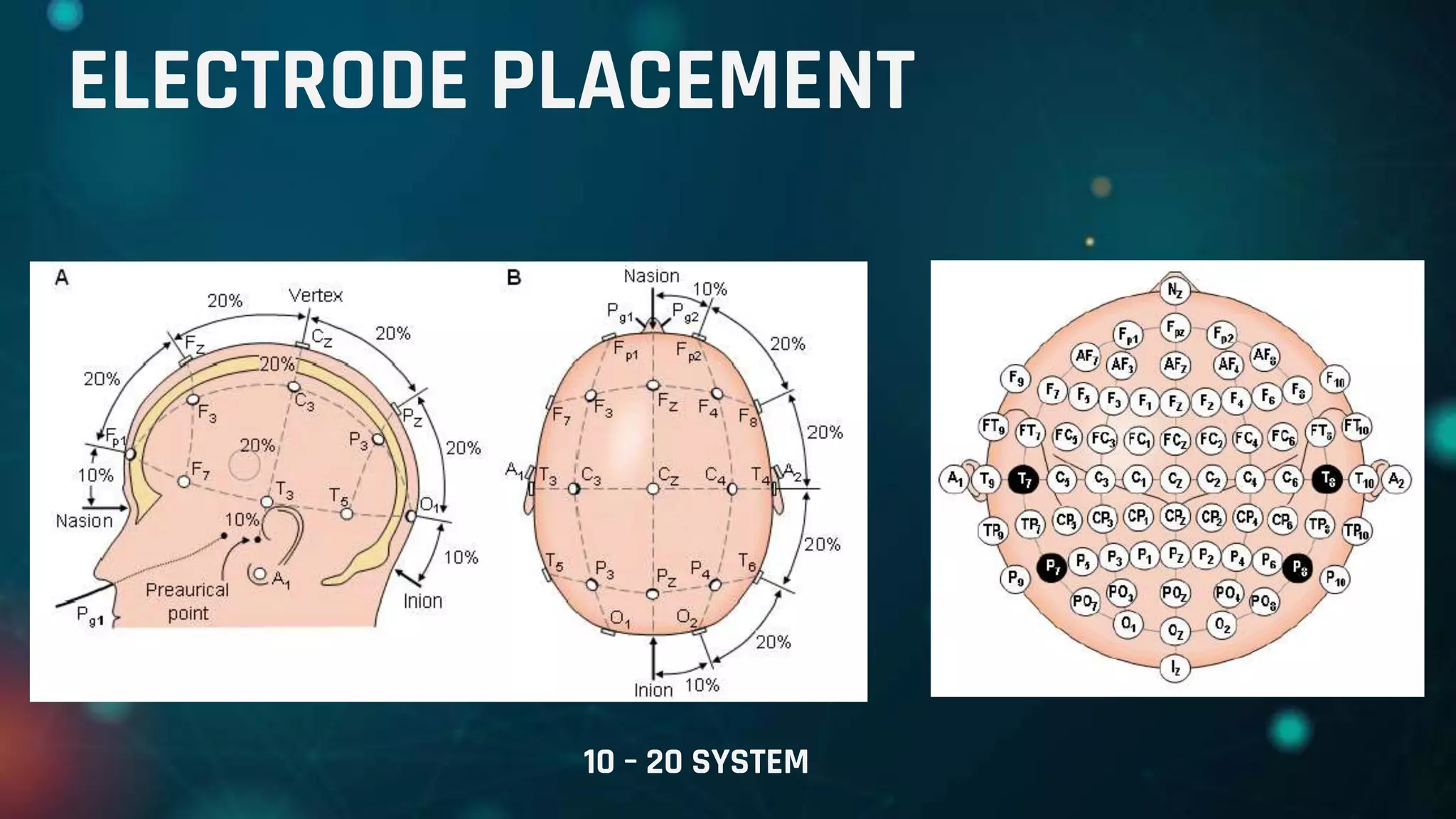 ELECTRODE PLACEMENT
10 – 20 SYSTEM
 
