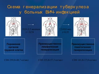 Схема г енерализации туберк улеза
у больных ВИЧ- инфек цией
Поражение
органов
грудной клетки
Преимущественно
лимфогенная
генерализация
Преимущественно
гематогенная
генерализация
CD4 239,0±48,7 кл/мкл CD4 141,8±17,8 кл/мклCD4 225,8±57,3 кл/мкл
19,9±3,5 месяцев
r = 0,74
7,2±0,8 мес.
r=0,35
 