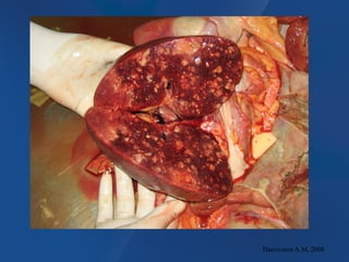 Пантелеев А.М, 2008
 