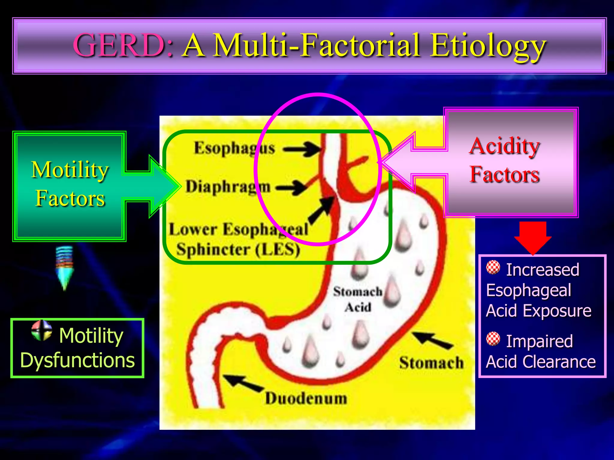 GERD: A Multi-Factorial Etiology

                               Acidity
 Motility                      Factors
 Factors

                                   Increased
                                Esophageal
                                Acid Exposure
    Motility                       Impaired
Dysfunctions                    Acid Clearance
 
