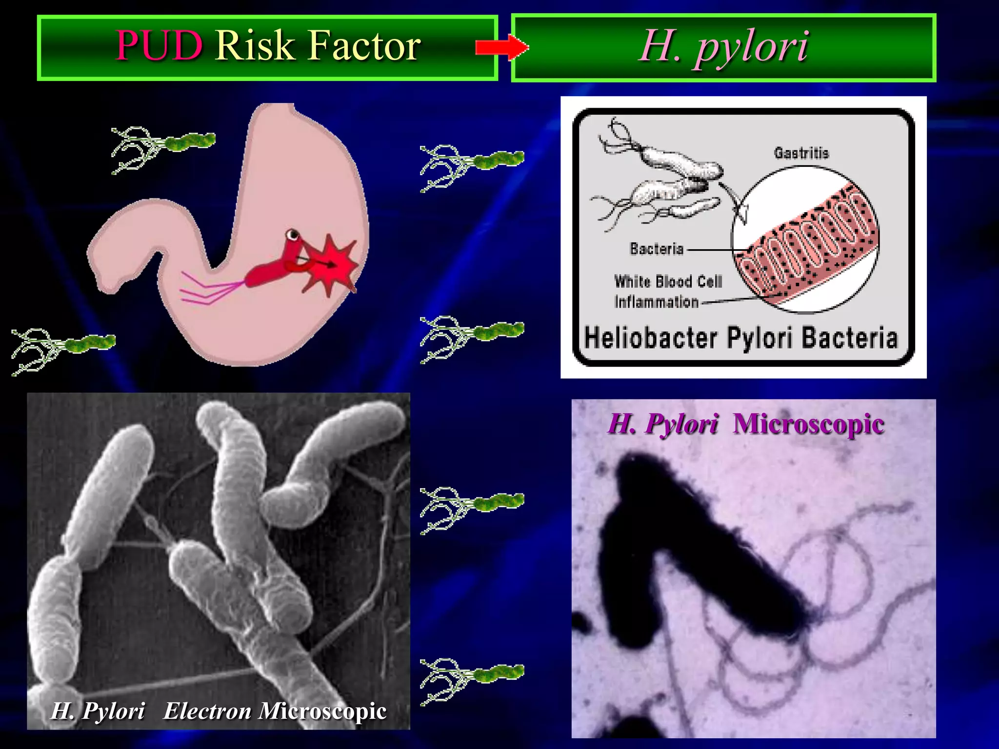 PUD Risk Factor               H. pylori




                                 H. Pylori Microscopic




H. Pylori Electron Microscopic
 
