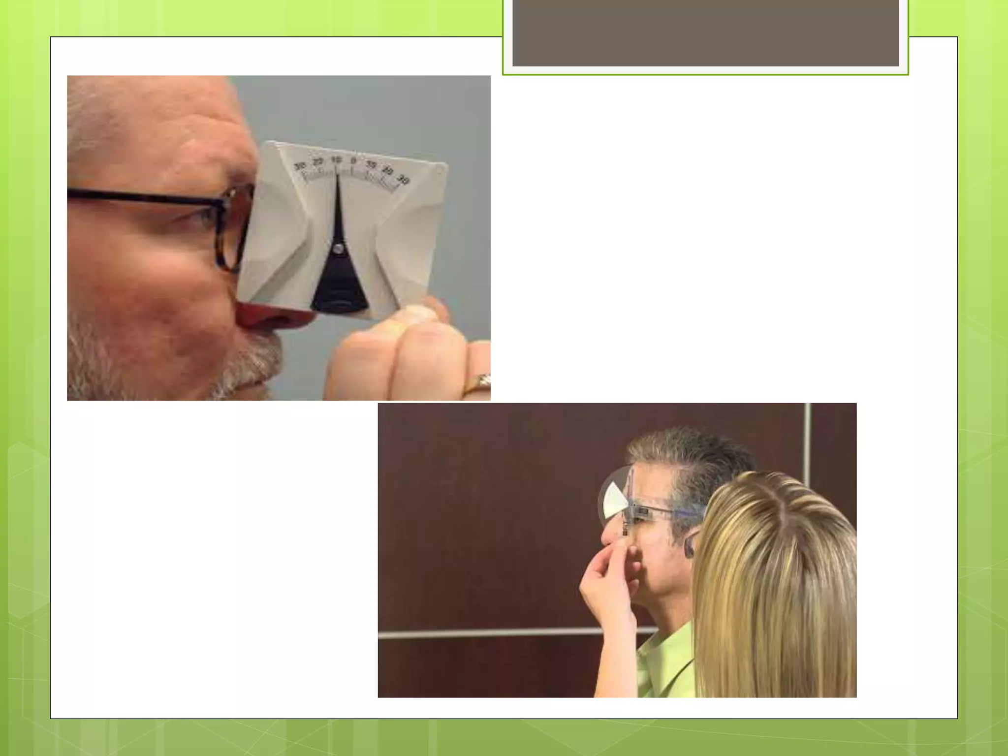 Pantoscopic tilt | PPTX