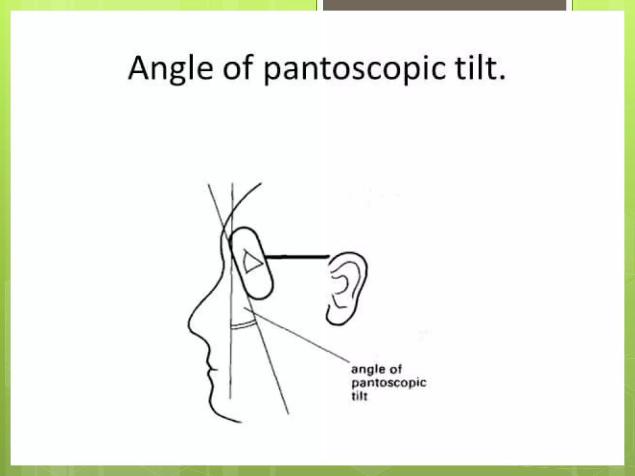 Pantoscopic tilt PPT