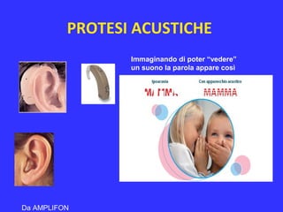 PROTESI ACUSTICHE
Immaginando di poter “vedere”
un suono la parola appare così
Da AMPLIFON
 