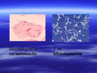 Microfotografías   Y de
del lactobacilo    bífidobacterias
 