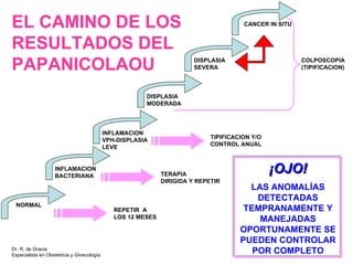 NORMAL INFLAMACION BACTERIANA INFLAMACION VPH-DISPLASIA LEVE DISPLASIA MODERADA DISPLASIA SEVERA CANCER IN SITU TIPIFICACION Y/O CONTROL ANUAL TERAPIA  DIRIGIDA Y REPETIR REPETIR  A LOS 12 MESES COLPOSCOPIA (TIPIFICACION) EL CAMINO DE LOS RESULTADOS DEL PAPANICOLAOU ¡OJO! LAS ANOMALÍAS DETECTADAS TEMPRANAMENTE Y MANEJADAS OPORTUNAMENTE SE PUEDEN CONTROLAR POR COMPLETO Dr. R. de Gracia Especialista en Obstetricia y Ginecología 
