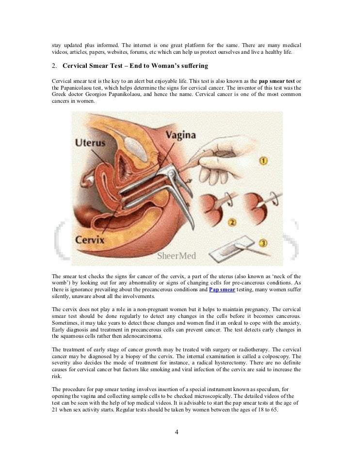 pap smear test