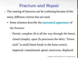 Copyright © John Wiley & Sons, Inc. All rights reserved.
Fracture and Repair
 The naming of fractures can be confusing because of the
many different criteria that are used.
 Some schemes describe the anatomical appearance of
the fracture:
• Partial, complete (fx is all the way through the bone),
closed (simple), open (fx punctures the skin), “Green
stick” (a small linear break in the bone cortex),
impacted, comminuted, spiral, transverse, displaced
 