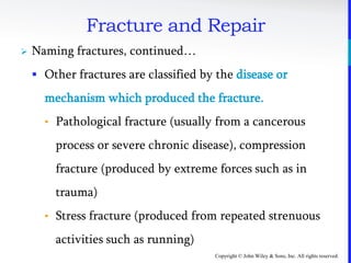 Copyright © John Wiley & Sons, Inc. All rights reserved.
Fracture and Repair
 Naming fractures, continued…
 Other fractures are classified by the disease or
mechanism which produced the fracture.
• Pathological fracture (usually from a cancerous
process or severe chronic disease), compression
fracture (produced by extreme forces such as in
trauma)
• Stress fracture (produced from repeated strenuous
activities such as running)
 