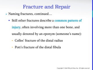 Copyright © John Wiley & Sons, Inc. All rights reserved.
Fracture and Repair
 Naming fractures, continued…
 Still other fractures describe a common pattern of
injury, often involving more than one bone, and
usually denoted by an eponym (someone’s name):
• Colles’ fracture of the distal radius
• Pott’s fracture of the distal fibula
 