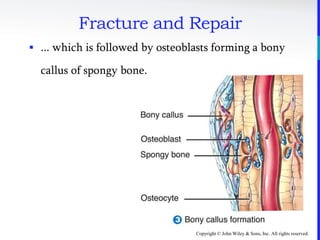 Copyright © John Wiley & Sons, Inc. All rights reserved.
Fracture and Repair
 ... which is followed by osteoblasts forming a bony
callus of spongy bone.
 