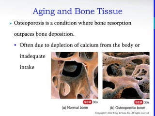 Copyright © John Wiley & Sons, Inc. All rights reserved.
Aging and Bone Tissue
 Osteoporosis is a condition where bone resorption
outpaces bone deposition.
 Often due to depletion of calcium from the body or
inadequate
intake
 