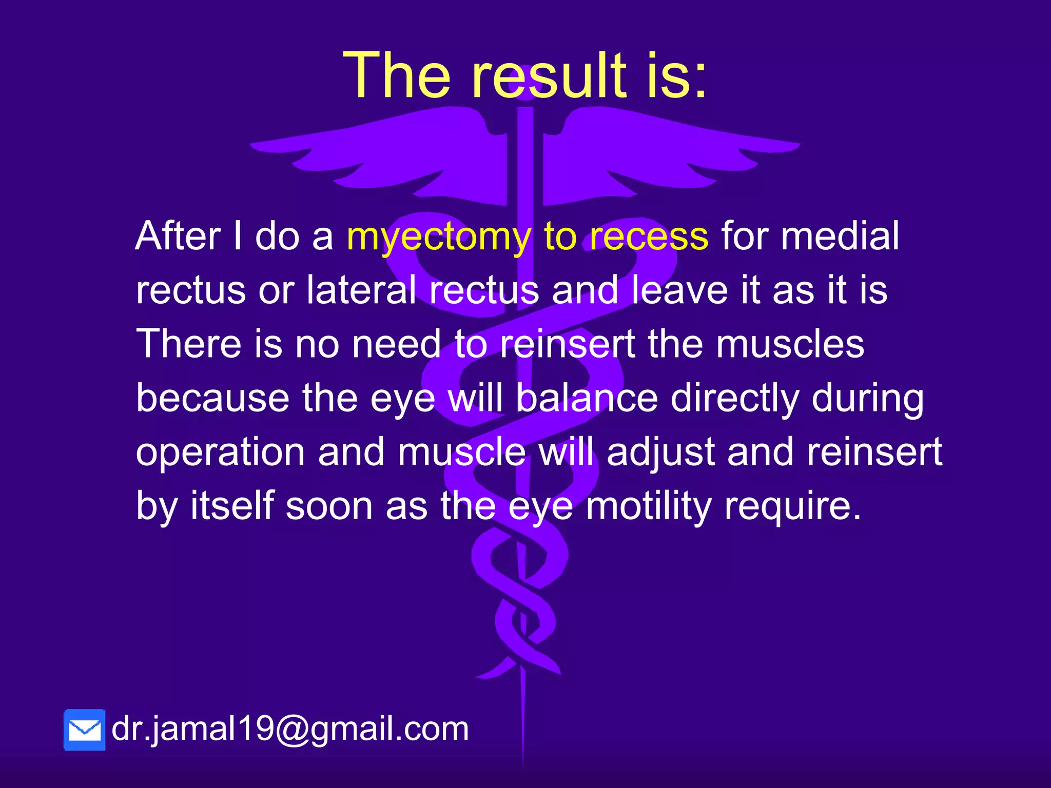 • I have operated about 74 primary squint
patients (XT-ET and some secondary cases –
re-operated) 34 of them preformed in Baish
General hospital, KSA and the rest in Libya.
• Different age group 6y– 70y.
• the observations of their results after using
this New technique for one year, two years
and three years.
So what about my
technique..
dr.jamal19@gmail.com
 