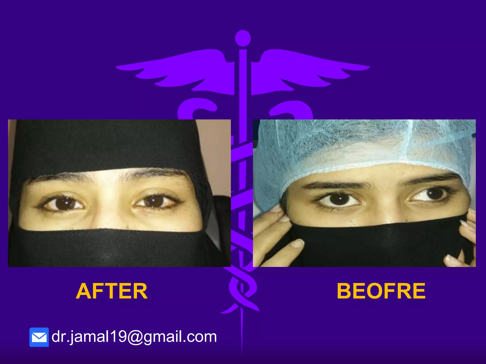 BEOFREAFTER
dr.jamal19@gmail.com
 