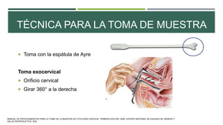 TÉCNICA PARA LA TOMA DE MUESTRA
 Toma con la espátula de Ayre
Toma exocervical
 Orificio cervical
 Girar 360° a la derecha
MANUAL DE PROCEDIMIENTOS PARA LA TOMA DE LA MUESTRA DE CITOLOGÍA CERVICAL. PRIMERA EDICIÓN. 2006. CENTRO NACIONAL DE EQUIDAD DE GÉNERO Y
SALUD REPRODUCTIVA. SSA.
 