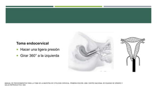 Toma endocervical
 Hacer una ligera presión
 Girar 360° a la izquierda
MANUAL DE PROCEDIMIENTOS PARA LA TOMA DE LA MUESTRA DE CITOLOGÍA CERVICAL. PRIMERA EDICIÓN. 2006. CENTRO NACIONAL DE EQUIDAD DE GÉNERO Y
SALUD REPRODUCTIVA. SSA.
 