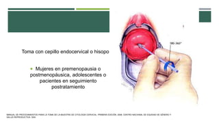 Toma con cepillo endocervical o hisopo
 Mujeres en premenopausia o
postmenopáusica, adolescentes o
pacientes en seguimiento
postratamiento
MANUAL DE PROCEDIMIENTOS PARA LA TOMA DE LA MUESTRA DE CITOLOGÍA CERVICAL. PRIMERA EDICIÓN. 2006. CENTRO NACIONAL DE EQUIDAD DE GÉNERO Y
SALUD REPRODUCTIVA. SSA.
 