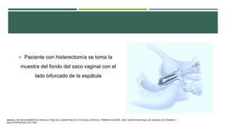  Paciente con histerectomía se toma la
muestra del fondo del saco vaginal con el
lado bifurcado de la espátula
MANUAL DE PROCEDIMIENTOS PARA LA TOMA DE LA MUESTRA DE CITOLOGÍA CERVICAL. PRIMERA EDICIÓN. 2006. CENTRO NACIONAL DE EQUIDAD DE GÉNERO Y
SALUD REPRODUCTIVA. SSA.
 