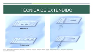 TÉCNICA DE EXTENDIDO
Exocervical
Endocervical
MANUAL DE PROCEDIMIENTOS PARA LA TOMA DE LA MUESTRA DE CITOLOGÍA CERVICAL. PRIMERA EDICIÓN. 2006. CENTRO NACIONAL DE EQUIDAD DE GÉNERO Y
SALUD REPRODUCTIVA. SSA.
 