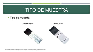 TIPO DE MUESTRA
 Tipo de muestra
SISTEMA BETHESDA: CITOLOGÍA CERVICO-VAGINAL. VIVAR, NICOLÁS. NETLAB. AGOSTO, 2006.
 