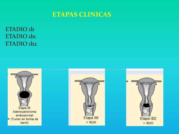 Papanicolau