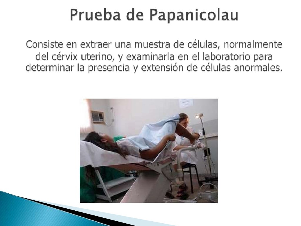 Papanicolau