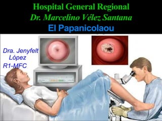 Hospital General RegionalDr. Marcelino Vélez SantanaEl Papanicolaou Dra. Jenyfelt López R1-MFC 
