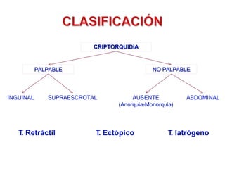 CRIPTORQUIDIA
PALPABLE NO PALPABLE
INGUINAL SUPRAESCROTAL AUSENTE
(Anorquia-Monorquia)
ABDOMINAL
T
. Retráctil T
. Ectópico T
. Iatrógeno
 