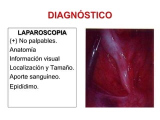 LAPAROSCOPIA
(+) No palpables.
Anatomía
Información visual
Localización y Tamaño.
Aporte sanguíneo.
Epidídimo.
 