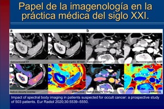 Papel de la imagenología en la
práctica médica del siglo XXI.
Impact of spectral body imaging in patients suspected for occult cancer: a prospective study
of 503 patients. Eur Radiol 2020;30:5539–5550.
 