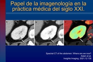 Papel de la imagenología en la
práctica médica del siglo XXI.
Spectral CT of the abdomen: Where are we now?
Adam et al.
Insights Imaging. 2021;12:138
 