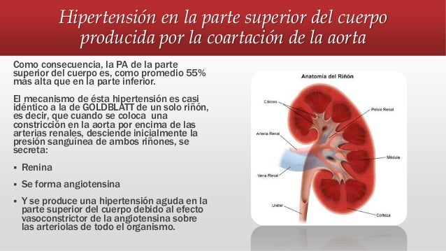 Resultado de imagen para Hipertensión en la parte alta del cuerpo, causada por la coartación aórtica.