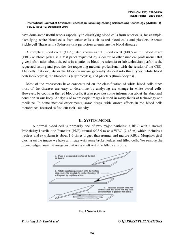 the internet essay ielts xii