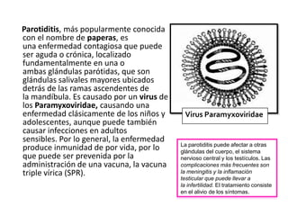 Paperas Inflamadas Paperas o Parotiditis | PPTX