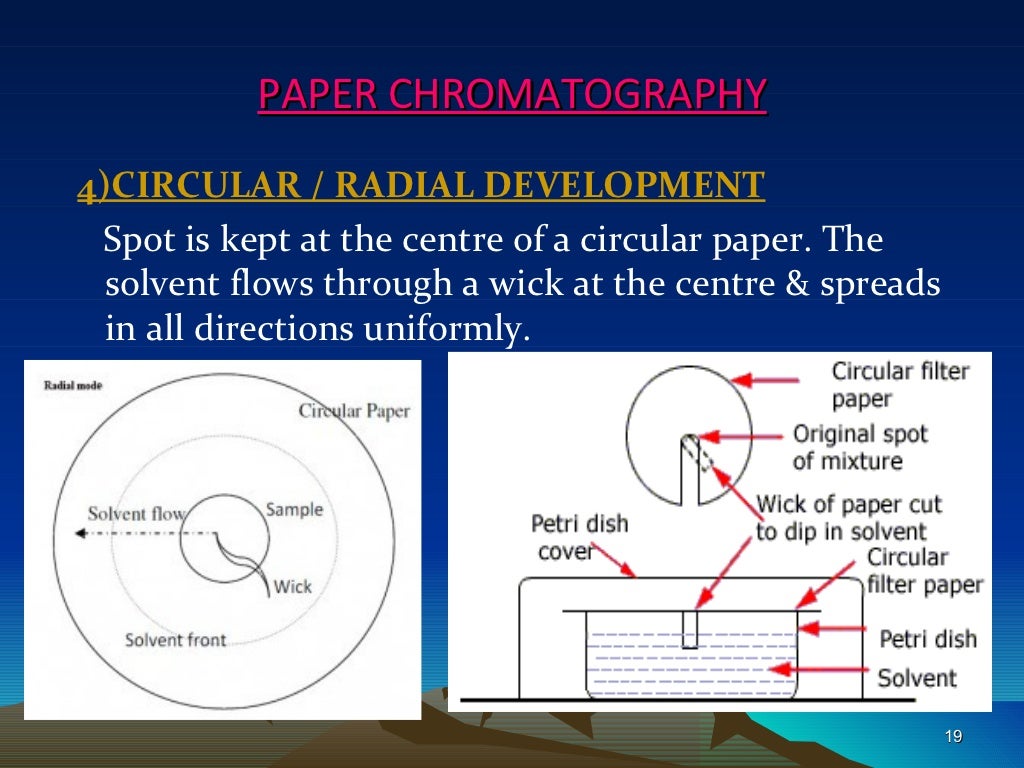 Hplc chromatography picture