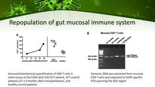 Repopulation of gut mucosal immune system
Immunohistochemical quantification of CD4 T cells in
colon tissue of the CCR5 ∆32/ ∆32 SCT patient, SCT control
patients (27 ± 9 months after transplantation), and
healthy control patients
Genomic DNA was extracted from mucosal
CD4 T cells and subjected to CCR5-specific
PCR spanning the ∆32 region
 
