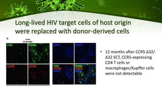 • 12 months after CCR5 ∆32/
∆32 SCT, CCR5-expressing
CD4 T cells or
macrophages/Kupffer cells
were not detectable
Long-lived HIV target cells of host origin
were replaced with donor-derived cells
 
