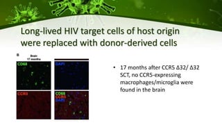 • 17 months after CCR5 ∆32/ ∆32
SCT, no CCR5-expressing
macrophages/microglia were
found in the brain
Long-lived HIV target cells of host origin
were replaced with donor-derived cells
 