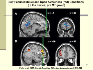 Farb, et al. 2007.  Social Cognitive Affective Neuroscience , 2:313-322 Self-Focused (blue) and Open Awareness (red) Conditions  (in the novice, pre MT group) 