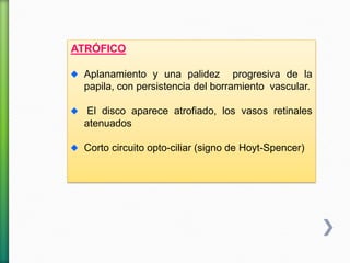 ATRÓFICO
Aplanamiento y una palidez progresiva de la
papila, con persistencia del borramiento vascular.
El disco aparece atrofiado, los vasos retinales
atenuados
Corto circuito opto-ciliar (signo de Hoyt-Spencer)
 