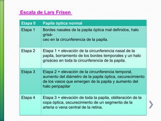 Escala de Lars Frisen
Etapa 0 Papila óptica normal
Etapa 1 Bordes nasales de la papila óptica mal definidos, halo
grisá-
ceo en la circunferencia de la papila.
Etapa 2 Etapa 1 + elevación de la circunferencia nasal de la
papila, borramiento de los bordes temporales y un halo
grisáceo en toda la circunferencia de la papila.
Etapa 3 Etapa 2 + elevación de la circunferencia temporal,
aumento del diámetro de la papila óptica, oscurecimiento
de los vasos que emergen de la papila y aumento del
halo peripapilar
Etapa 4 Etapa 3 + elevación de toda la papila, obliteración de la
copa óptica, oscurecimiento de un segmento de la
arteria o vena central de la retina.
 