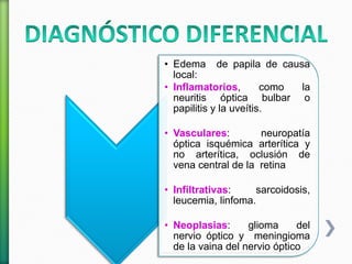 • Edema de papila de causa
local:
• Inflamatorios, como la
neuritis óptica bulbar o
papilitis y la uveítis.
• Vasculares: neuropatía
óptica isquémica arterítica y
no arterítica, oclusión de
vena central de la retina
• Infiltrativas: sarcoidosis,
leucemia, linfoma.
• Neoplasias: glioma del
nervio óptico y meningioma
de la vaina del nervio óptico
 