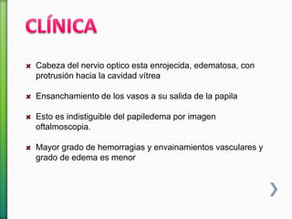 Cabeza del nervio optico esta enrojecida, edematosa, con
protrusión hacia la cavidad vítrea
Ensanchamiento de los vasos a su salida de la papila
Esto es indistiguible del papiledema por imagen
oftalmoscopia.
Mayor grado de hemorragias y envainamientos vasculares y
grado de edema es menor
 