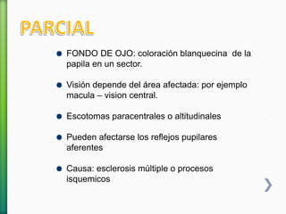 FONDO DE OJO: coloración blanquecina de la
papila en un sector.
Visión depende del área afectada: por ejemplo
macula – vision central.
Escotomas paracentrales o altitudinales
Pueden afectarse los reflejos pupilares
aferentes
Causa: esclerosis múltiple o procesos
isquemicos
 
